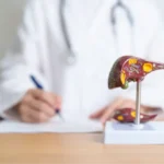 Can Cirrhosis of the Liver Be Reversed?
