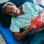 Yttrium-90 TheraSphere Liver Cancer Therapy