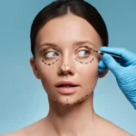 fox eye surgery