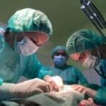 Bursa Removal Surgery