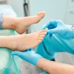 Lapiplasty Surgery