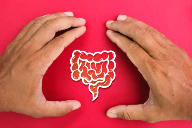 Ulcerative Colitis