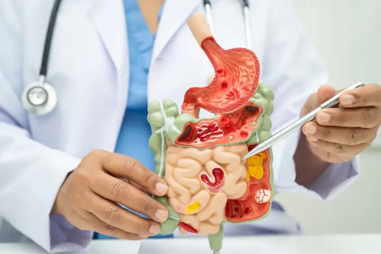 Crohn’s Disease